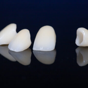Tips for Prolonging The Lifespan of Dental Crowns
