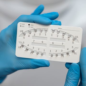 How Orthodontic Dentistry Improves Bite, Alignment, and Jaw Health