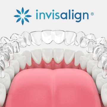 Can Adults in Scarborough Get Invisalign After 30? Yes, Here’s Why!