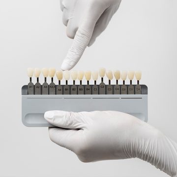 Can Dental Veneers Be the Fastest Way to Transform Your Smile?