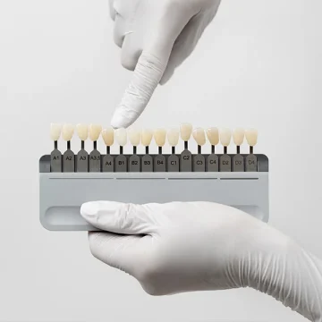 What Foods Should You Avoid After Getting Dental Veneers?
